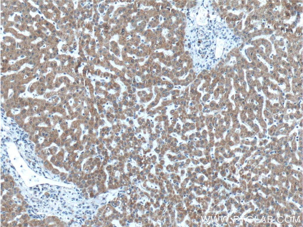 Immunohistochemistry (IHC) staining of human liver tissue using FAM172A Polyclonal antibody (24732-1-AP)