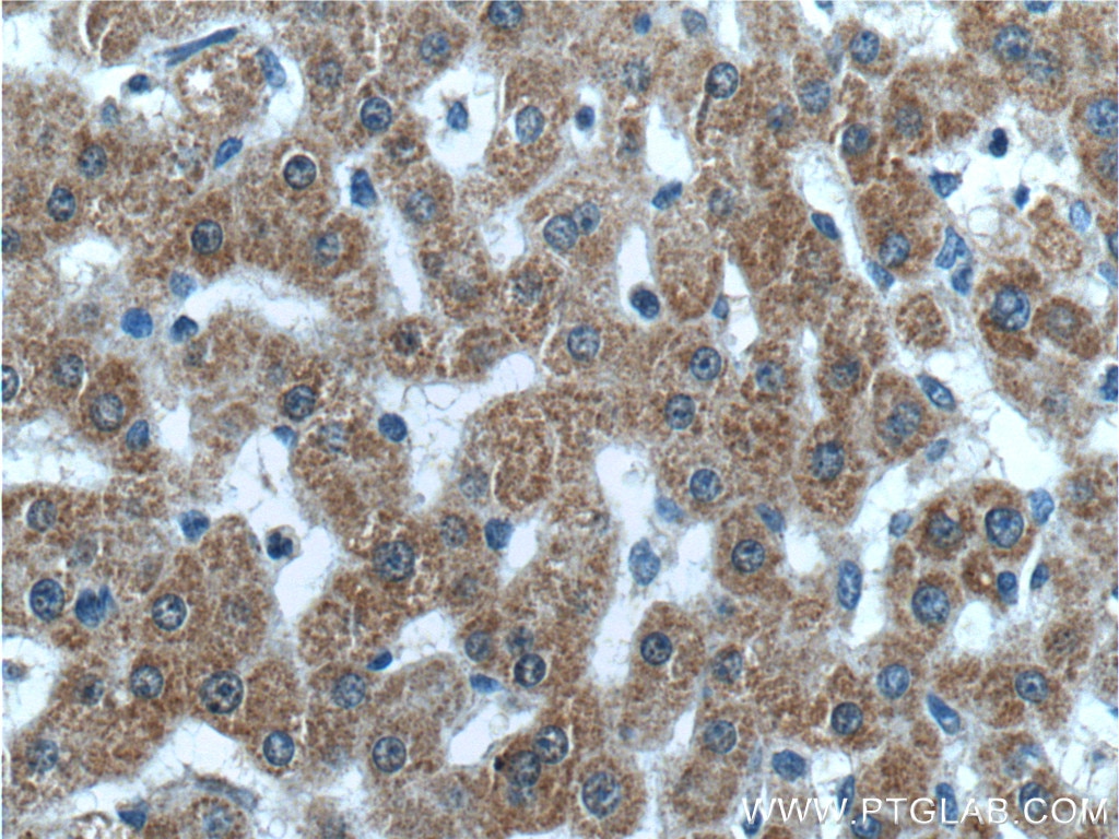 Immunohistochemistry (IHC) staining of human liver tissue using FAM172A Polyclonal antibody (24732-1-AP)