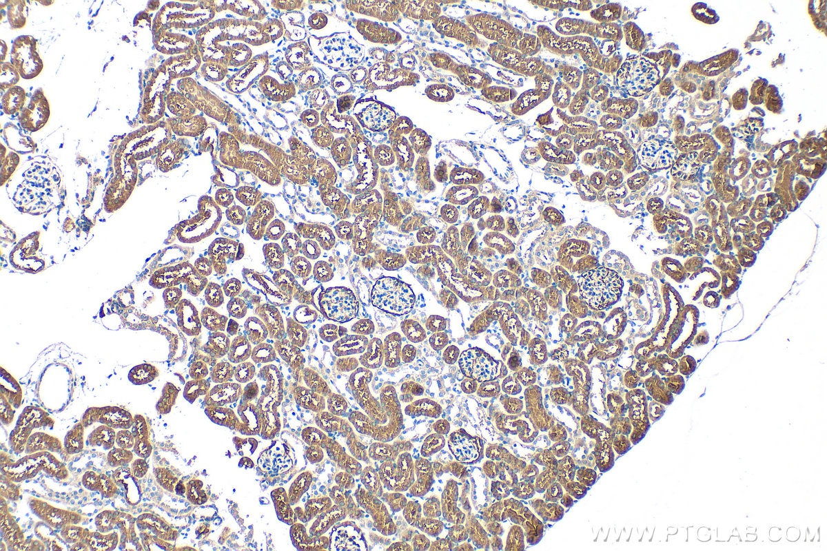 Immunohistochemistry (IHC) staining of mouse kidney tissue using FAM173A Polyclonal antibody (32901-1-AP)