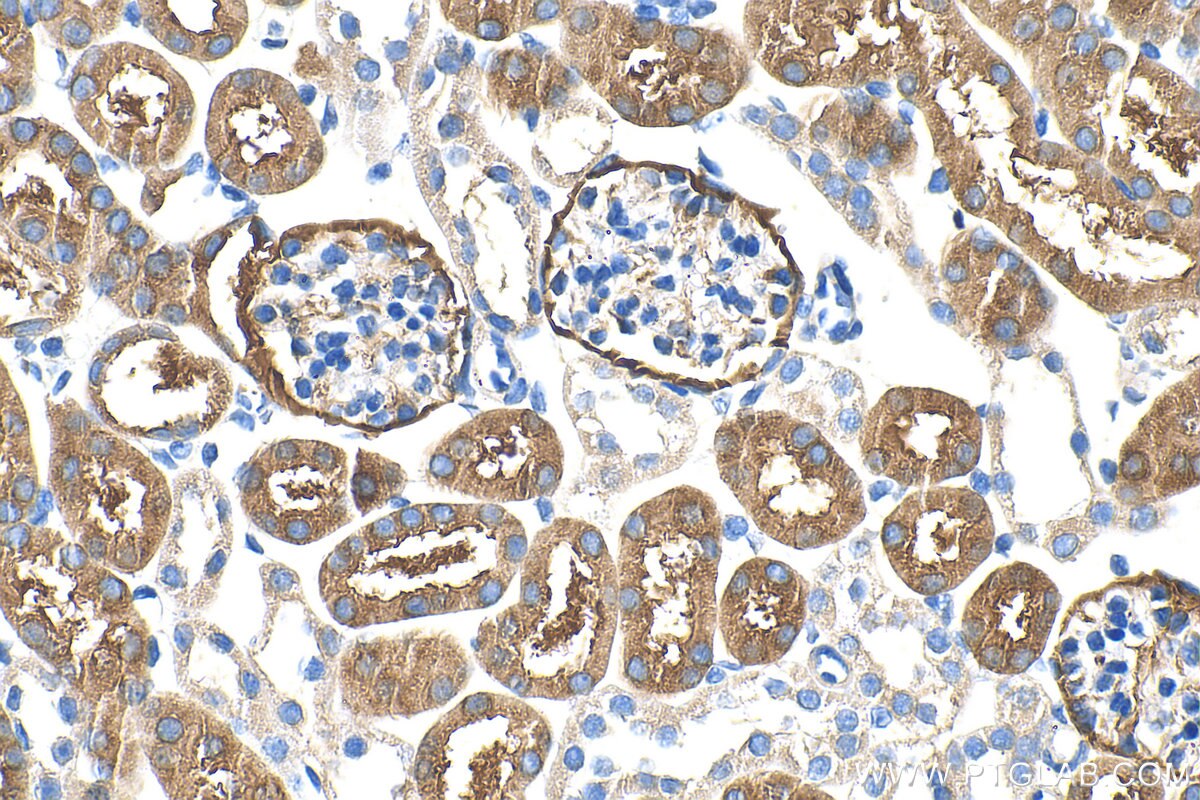 Immunohistochemistry (IHC) staining of mouse kidney tissue using FAM173A Polyclonal antibody (32901-1-AP)