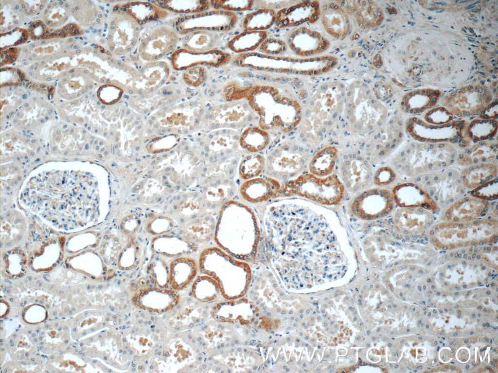 Immunohistochemistry (IHC) staining of human kidney tissue using FAM174A Polyclonal antibody (24802-1-AP)