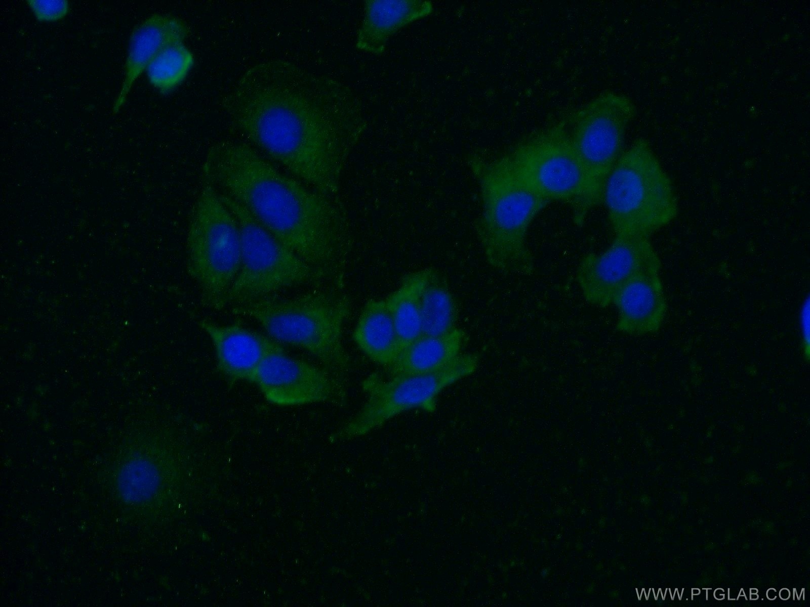 Immunofluorescence (IF) / fluorescent staining of MCF-7 cells using FAM175A Polyclonal antibody (14366-1-AP)