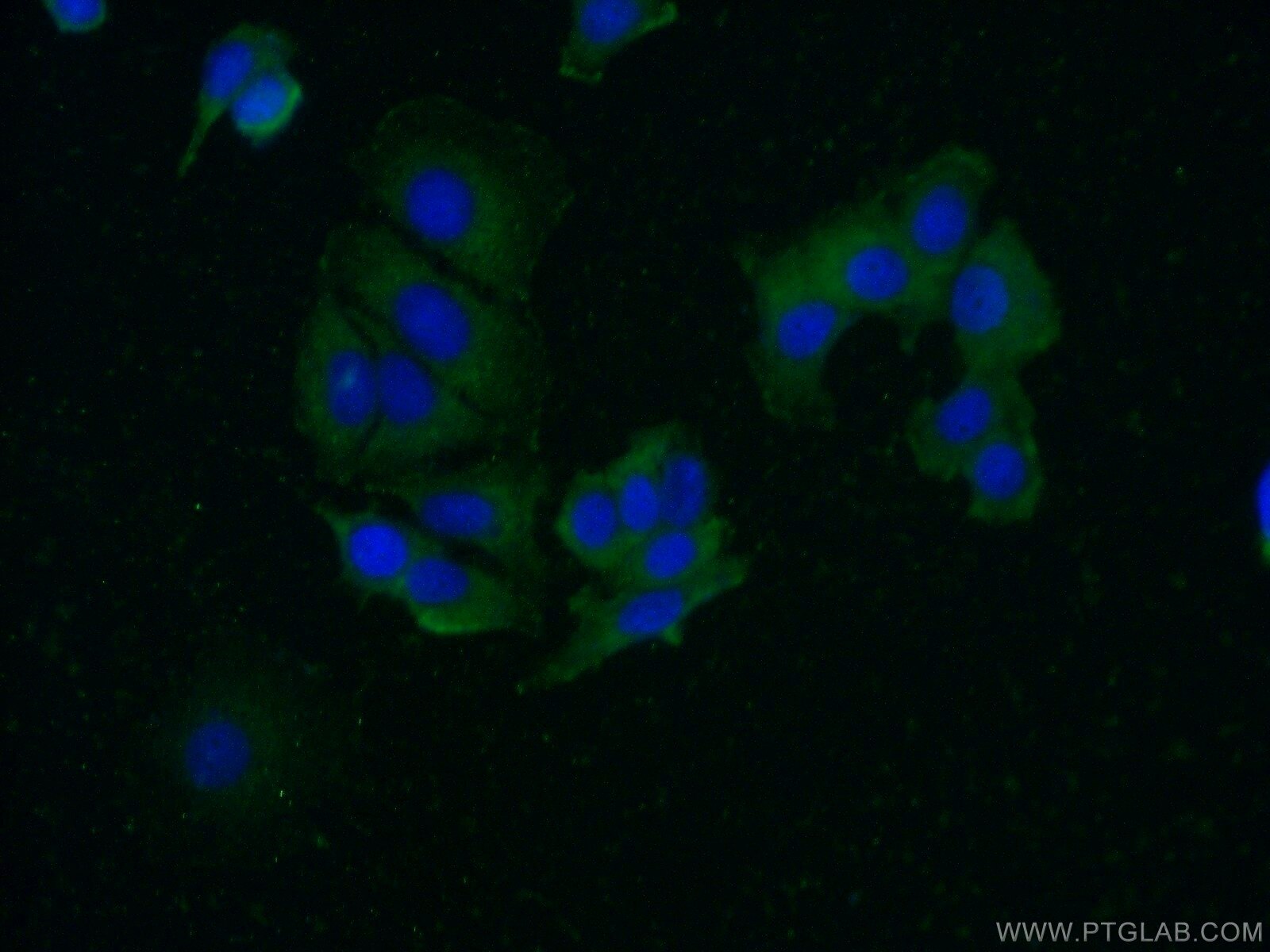 Immunofluorescence (IF) / fluorescent staining of MCF-7 cells using FAM175A Polyclonal antibody (14366-1-AP)