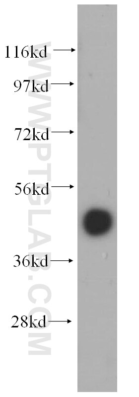 Western Blot (WB) analysis of human testis tissue using FAM175A Polyclonal antibody (14366-1-AP)