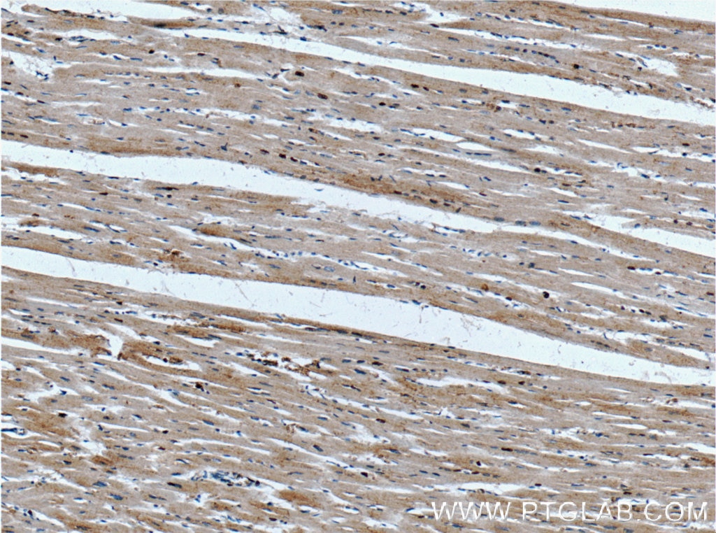 Immunohistochemistry (IHC) staining of human heart tissue using FAM175B Polyclonal antibody (26868-1-AP)