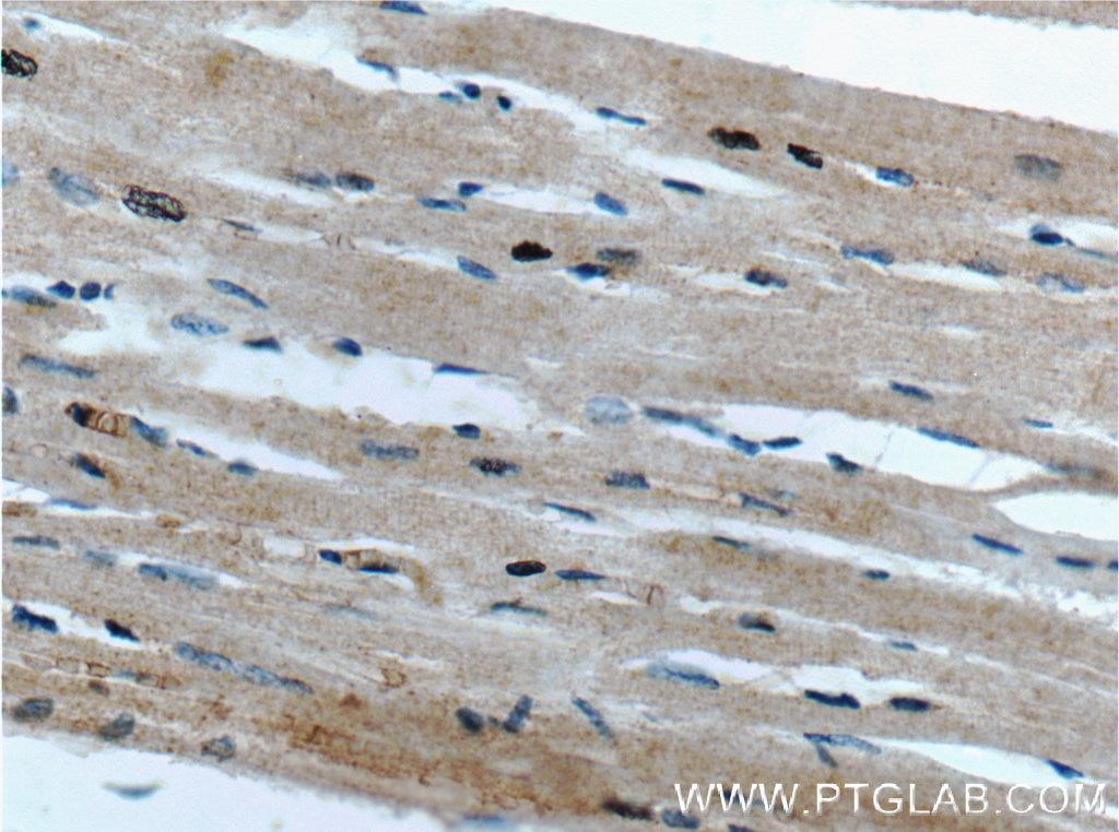 IHC staining of human heart using 26868-1-AP