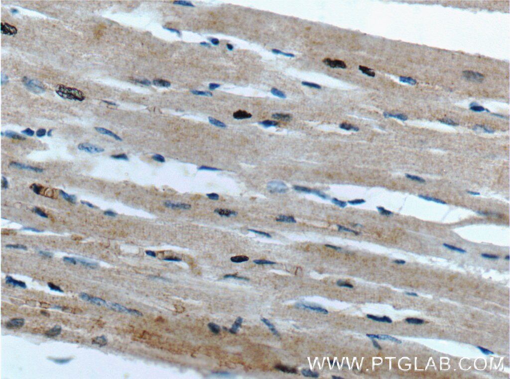 Immunohistochemistry (IHC) staining of human heart tissue using FAM175B Polyclonal antibody (26868-1-AP)