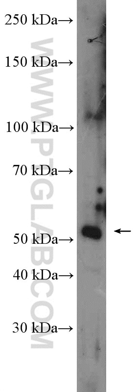 Western Blot (WB) analysis of HEK-293 cells using FAM175B Polyclonal antibody (26868-1-AP)