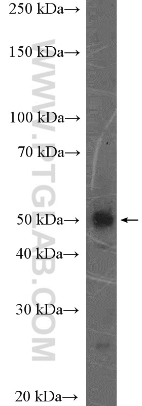 WB analysis of mouse heart using 26868-1-AP