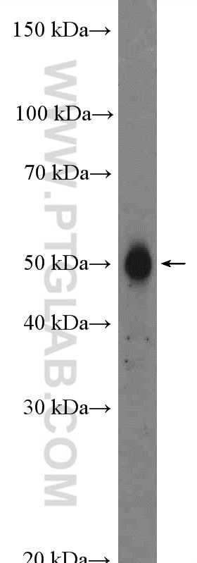 Western Blot (WB) analysis of HL-60 cells using FAM175B Polyclonal antibody (26868-1-AP)