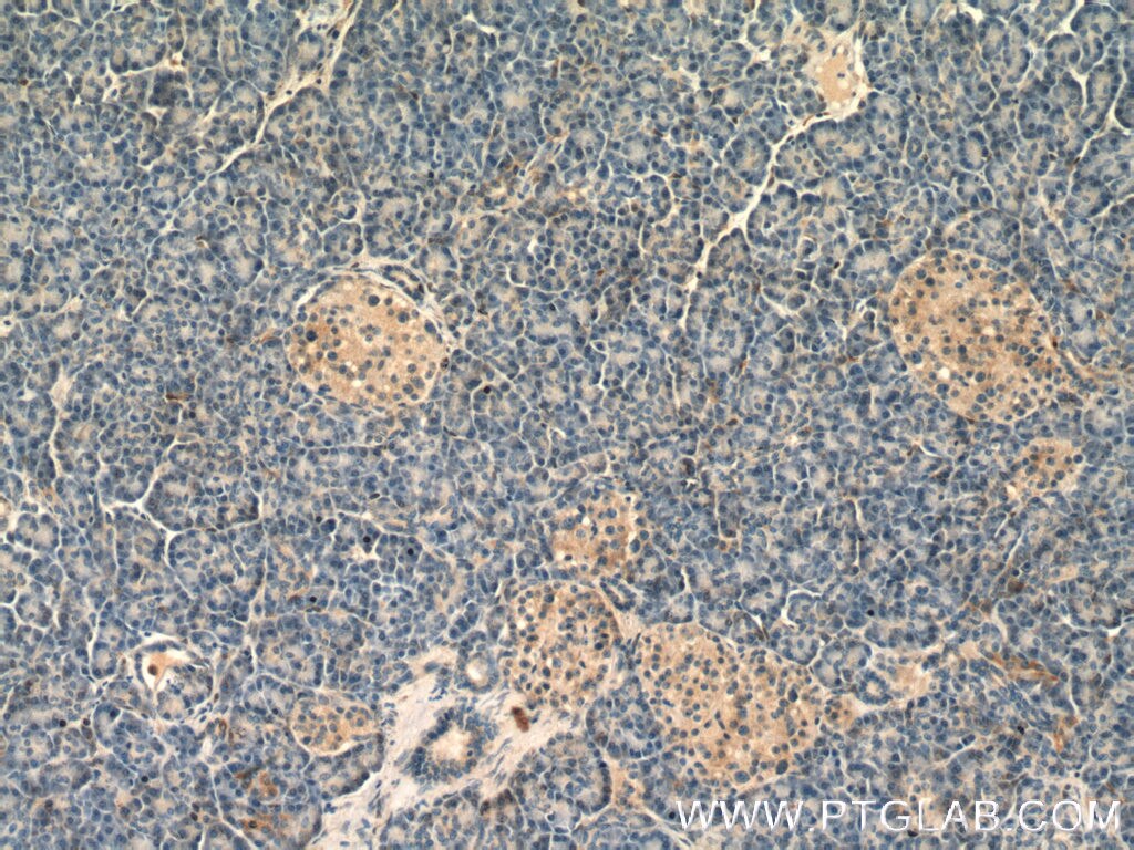 Immunohistochemistry (IHC) staining of human pancreas tissue using EVA1A Polyclonal antibody (26726-1-AP)