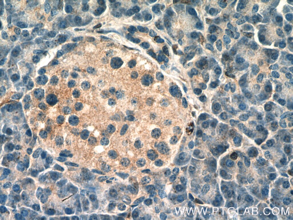 Immunohistochemistry (IHC) staining of human pancreas tissue using EVA1A Polyclonal antibody (26726-1-AP)