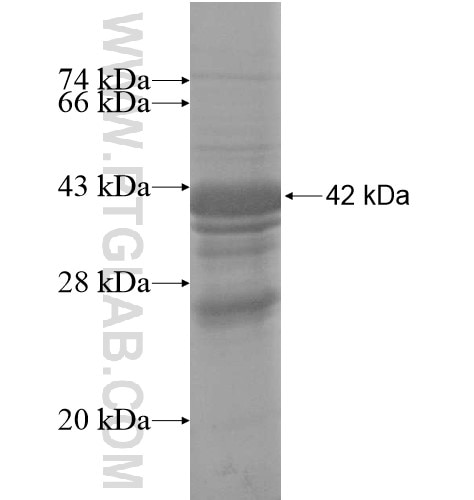 FAM176B fusion protein Ag14578 SDS-PAGE