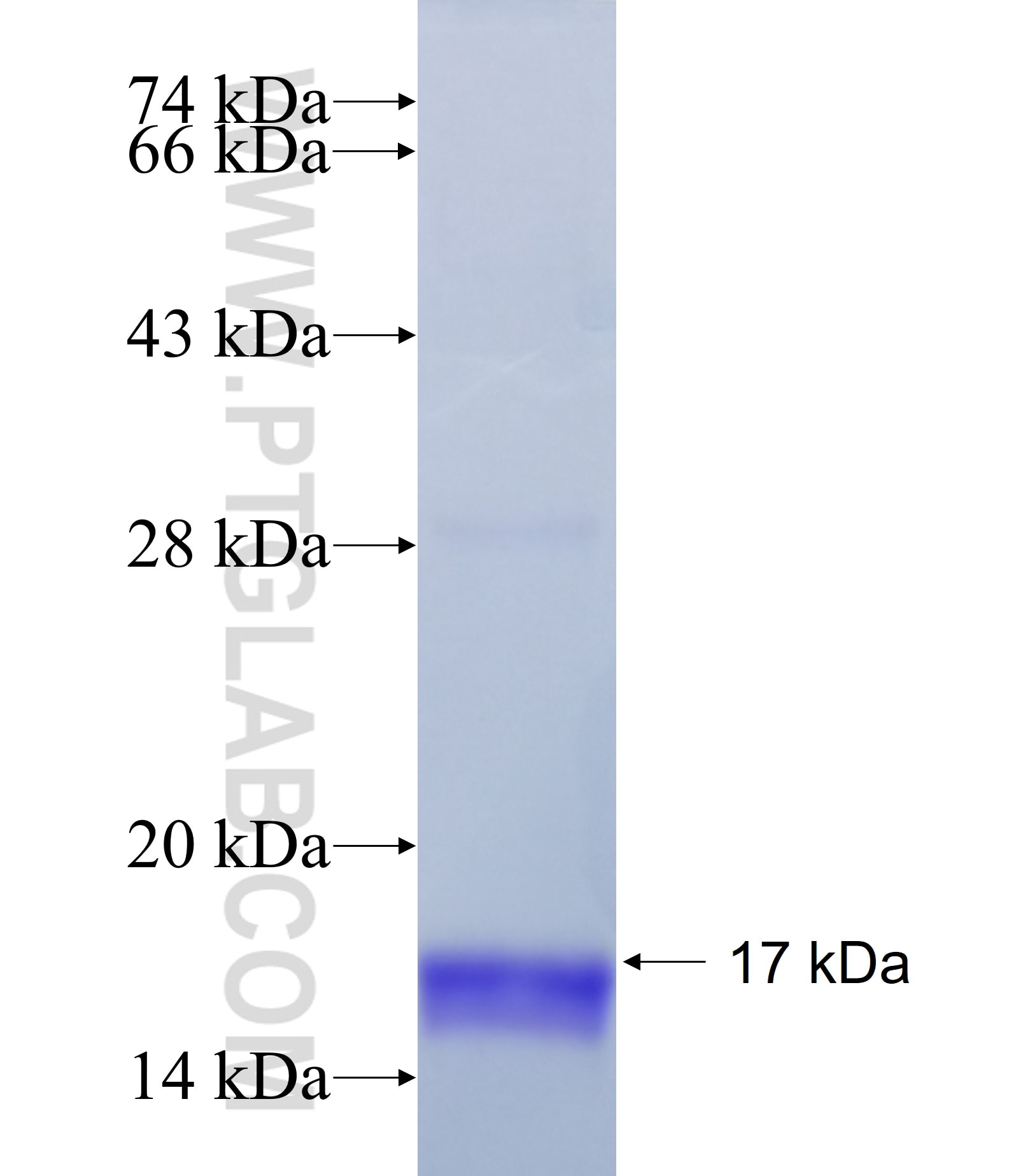 FAM178B fusion protein Ag37855 SDS-PAGE FAM178B fusion protein Ag37855 SDS-PAGE