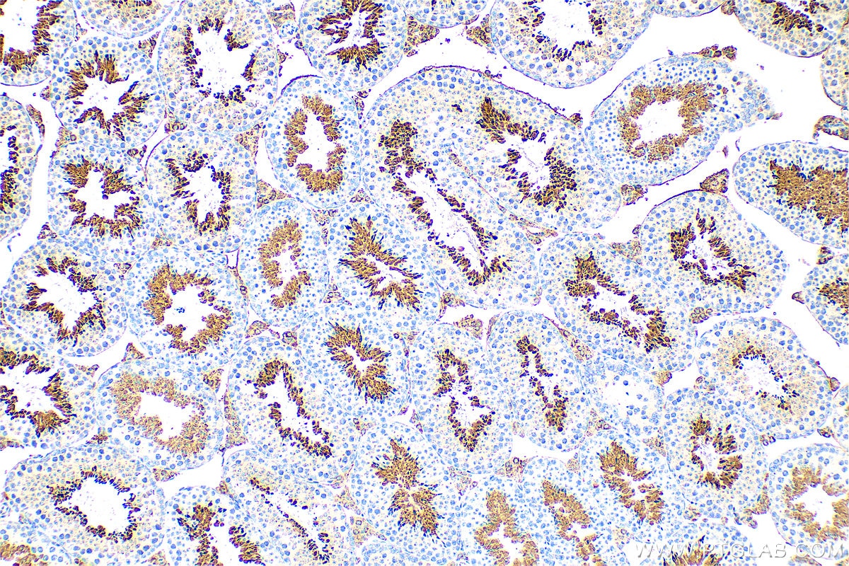 Immunohistochemistry (IHC) staining of mouse testis tissue using FAM181A Polyclonal antibody (26509-1-AP)