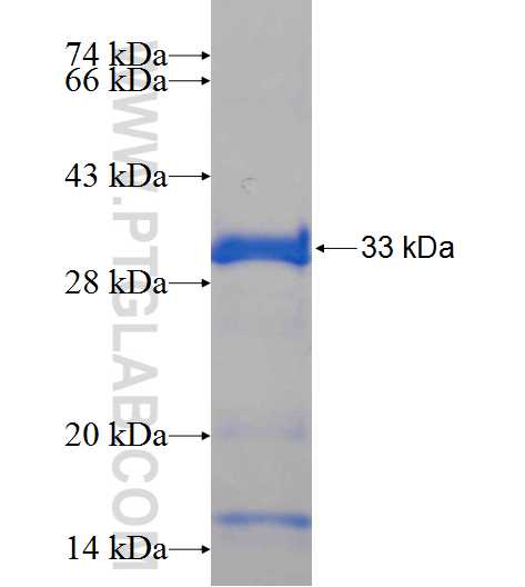 FAM181A fusion protein Ag24150 SDS-PAGE