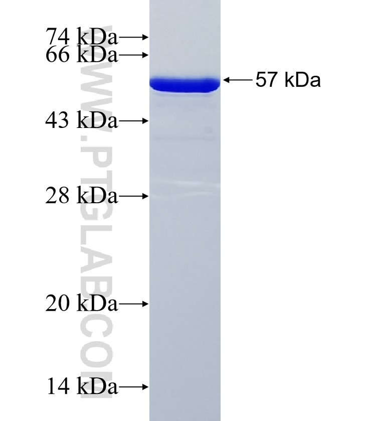 FAM184B fusion protein Ag35430 SDS-PAGE FAM184B fusion protein Ag35430 SDS-PAGE