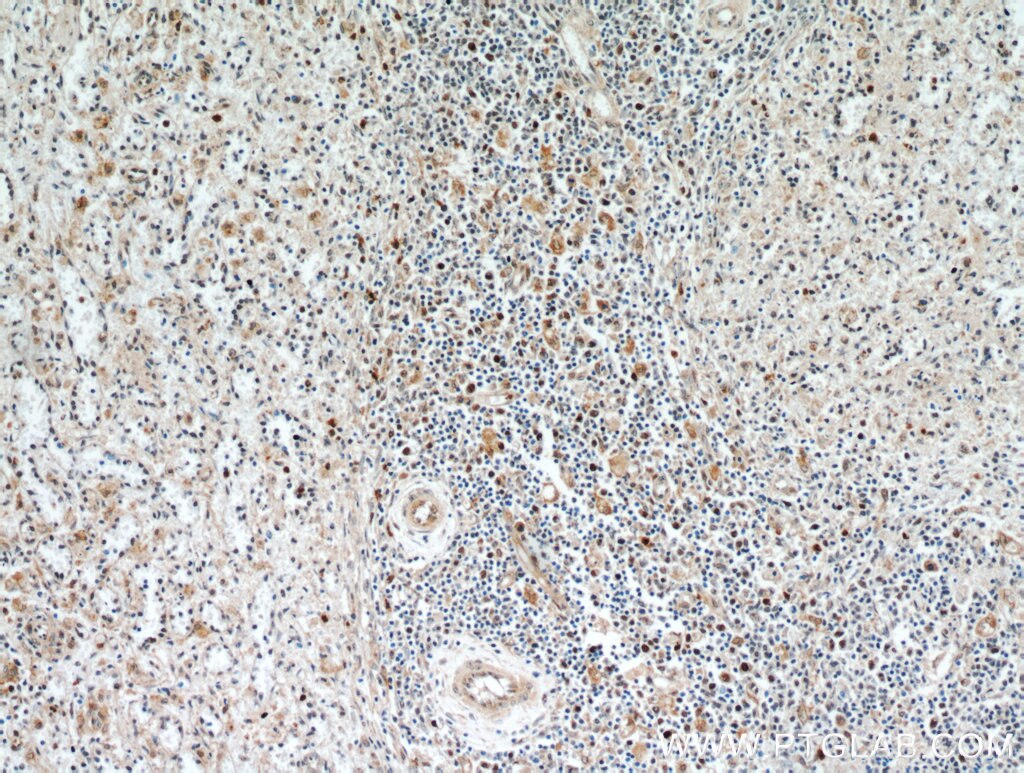 Immunohistochemistry (IHC) staining of human spleen tissue using FAM185A Polyclonal antibody (20911-1-AP)