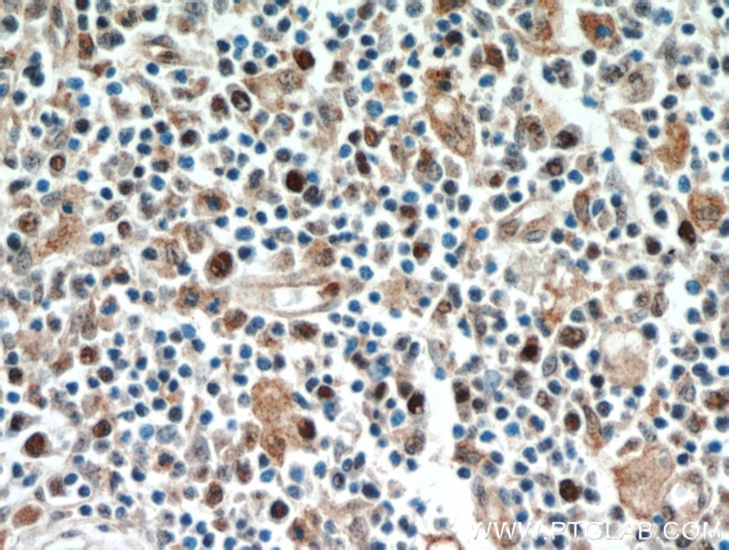 Immunohistochemistry (IHC) staining of human spleen tissue using FAM185A Polyclonal antibody (20911-1-AP)