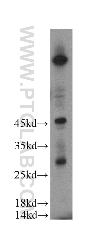 Western Blot (WB) analysis of HeLa cells using FAM185A Polyclonal antibody (20911-1-AP)