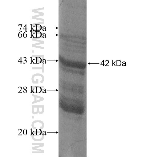 FAM185A fusion protein Ag15041 SDS-PAGE