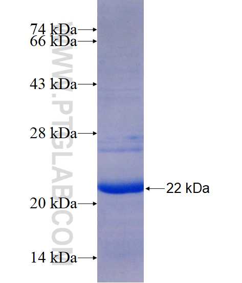 FAM185A fusion protein Ag15439 SDS-PAGE