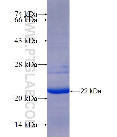 FAM185A fusion protein Ag15439 SDS-PAGE
