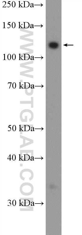 Western Blot (WB) analysis of HeLa cells using FAM186B Polyclonal antibody (21022-1-AP)