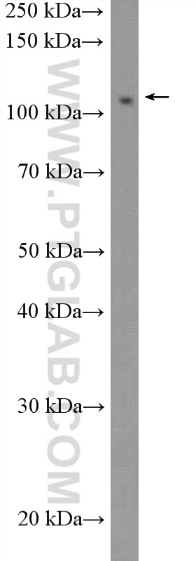 Western Blot (WB) analysis of HeLa cells using FAM186B Polyclonal antibody (21022-1-AP)