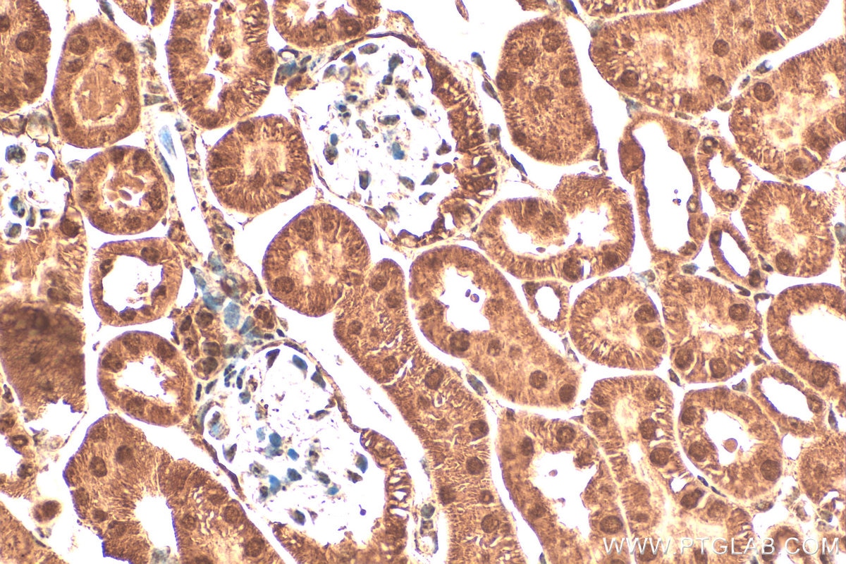Immunohistochemistry (IHC) staining of mouse kidney tissue using FAM190B Polyclonal antibody (21078-1-AP)