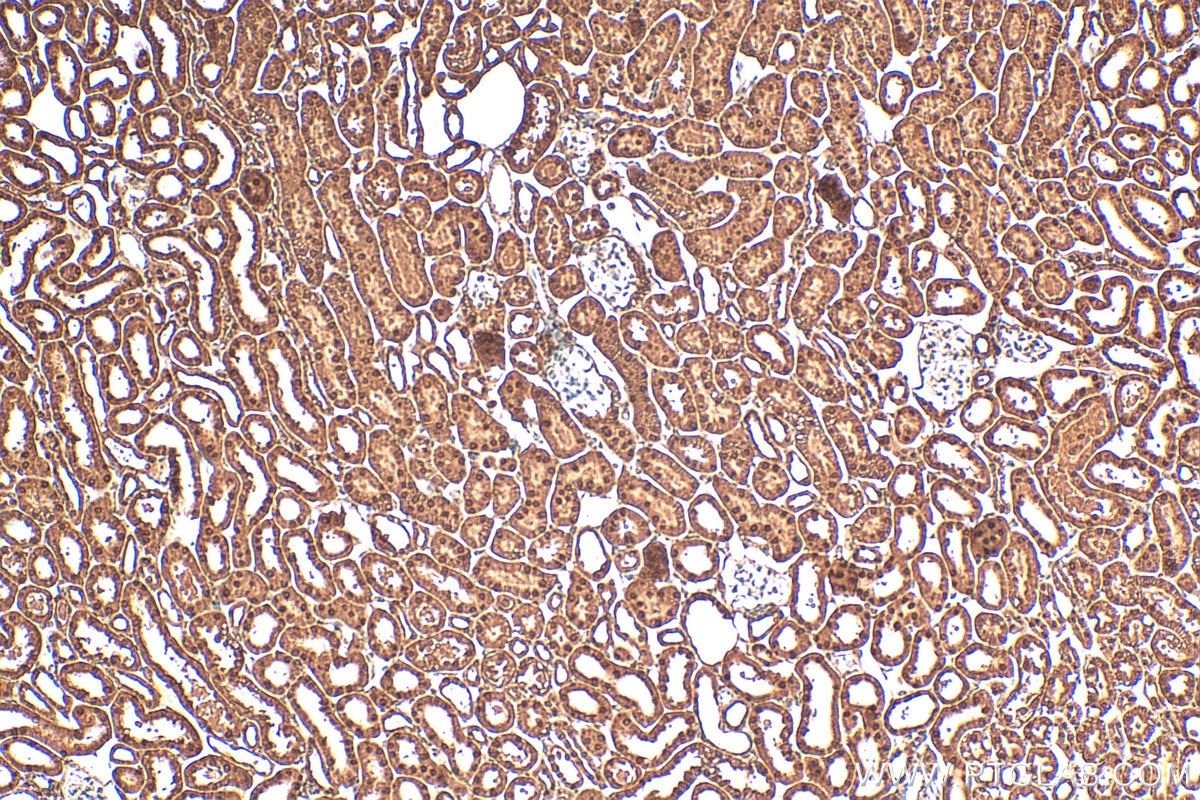 Immunohistochemistry (IHC) staining of mouse kidney tissue using FAM190B Polyclonal antibody (21078-1-AP)