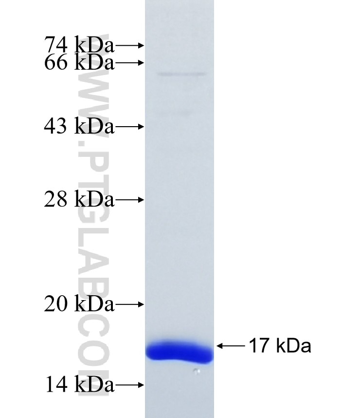 FAM19A2 fusion protein Ag38250 SDS-PAGE FAM19A2 fusion protein Ag38250 SDS-PAGE