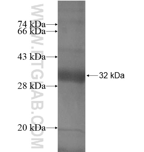 FAM19A4 fusion protein Ag15047 SDS-PAGE