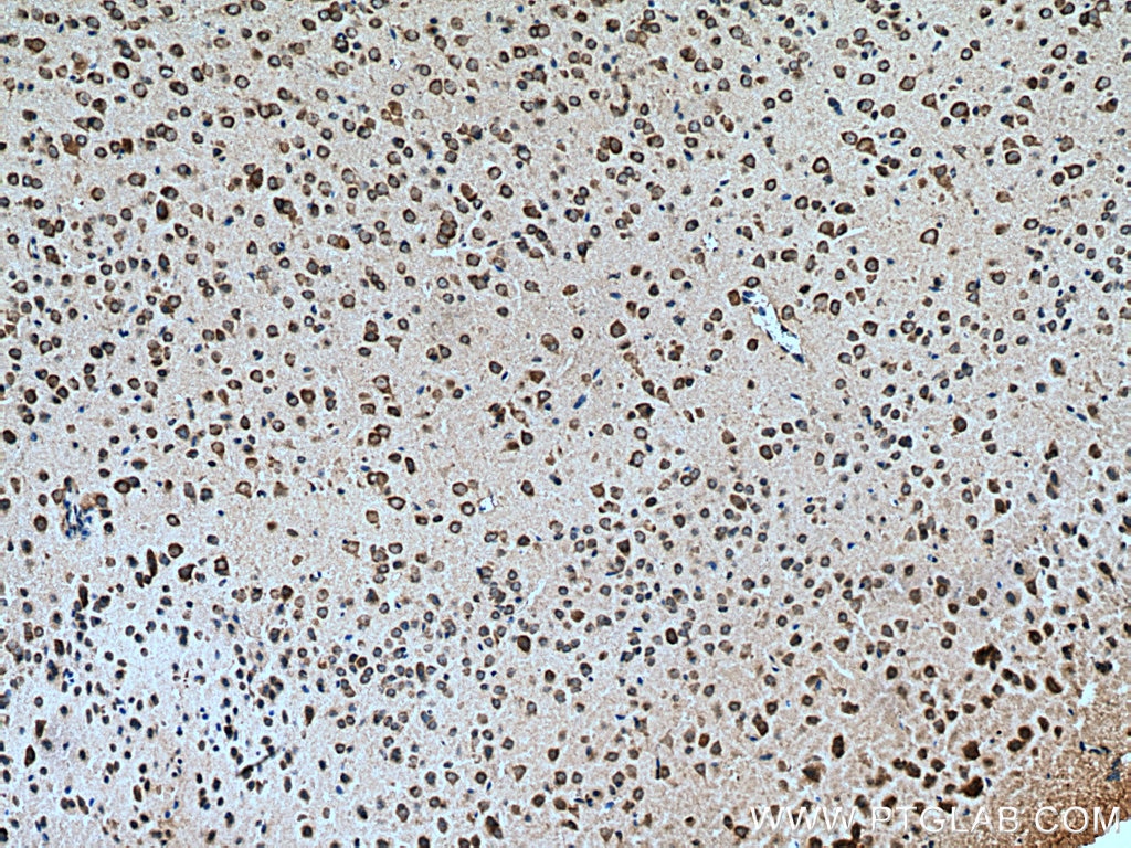 IHC staining of mouse brain using 13948-1-AP