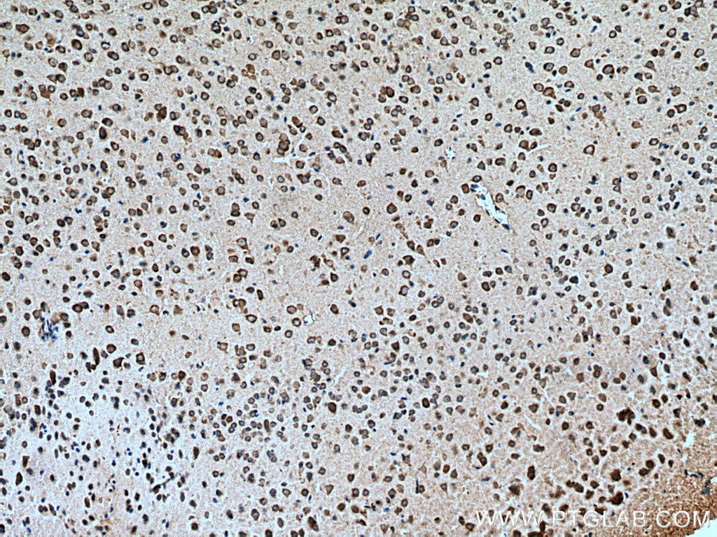 Immunohistochemistry (IHC) staining of mouse brain tissue using FAM19A5 Polyclonal antibody (13948-1-AP)