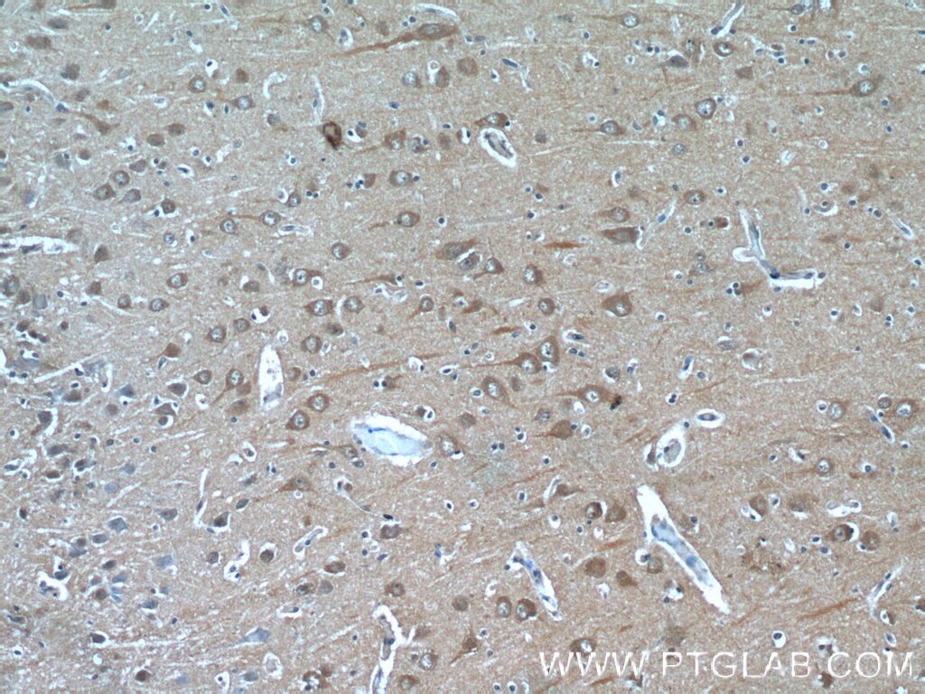 Immunohistochemistry (IHC) staining of human brain tissue using FAM19A5 Polyclonal antibody (13948-1-AP)