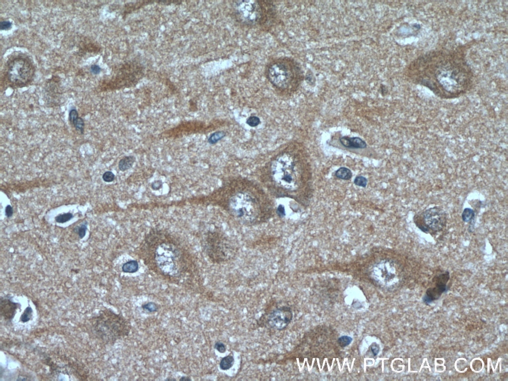 Immunohistochemistry (IHC) staining of human brain tissue using FAM19A5 Polyclonal antibody (13948-1-AP)