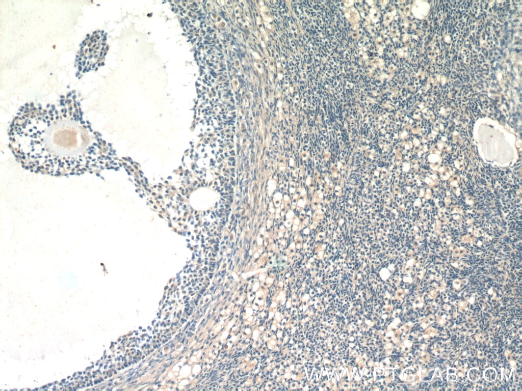 IHC staining of human ovary using 25258-1-AP