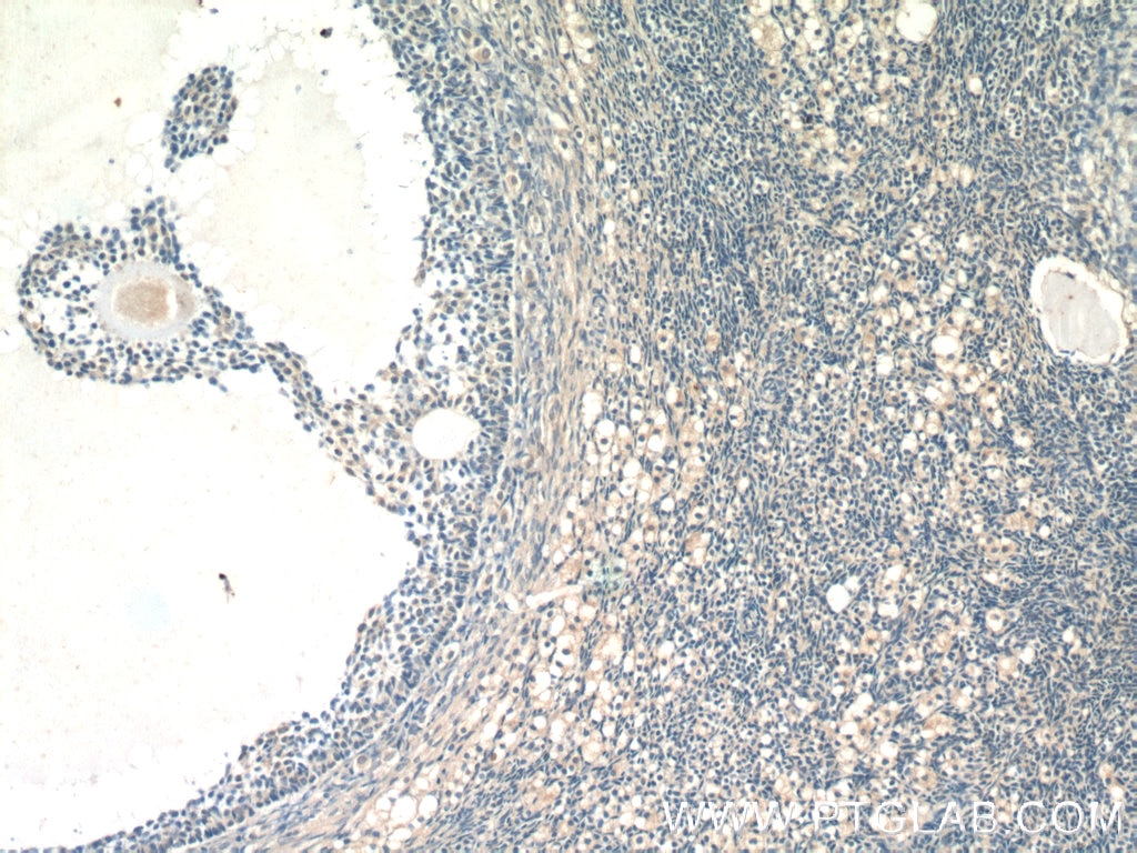 Immunohistochemistry (IHC) staining of human ovary tissue using FAM20A Polyclonal antibody (25258-1-AP)