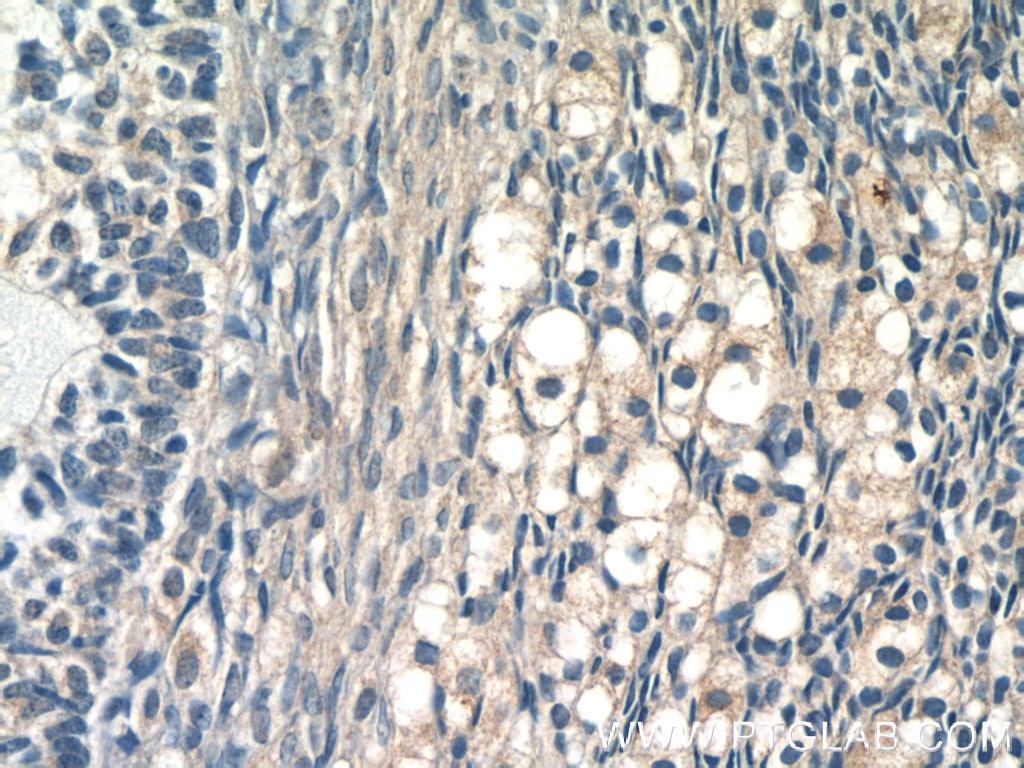 Immunohistochemistry (IHC) staining of human ovary tissue using FAM20A Polyclonal antibody (25258-1-AP)