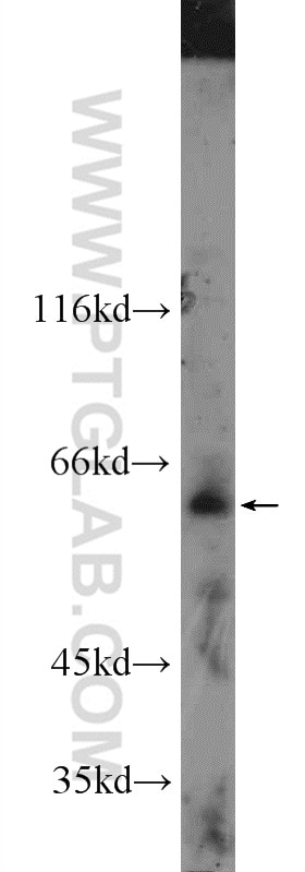 Western Blot (WB) analysis of mouse lung tissue using FAM20A Polyclonal antibody (25258-1-AP)