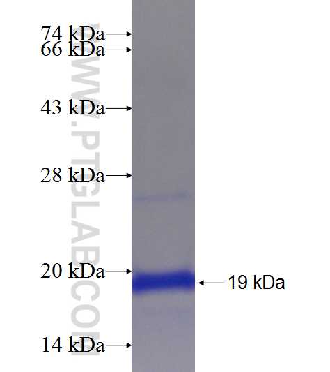 FAM20A fusion protein Ag19494 SDS-PAGE