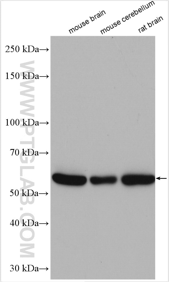 Western Blot (WB) analysis of various lysates using FAM20B Polyclonal antibody (19134-1-AP)