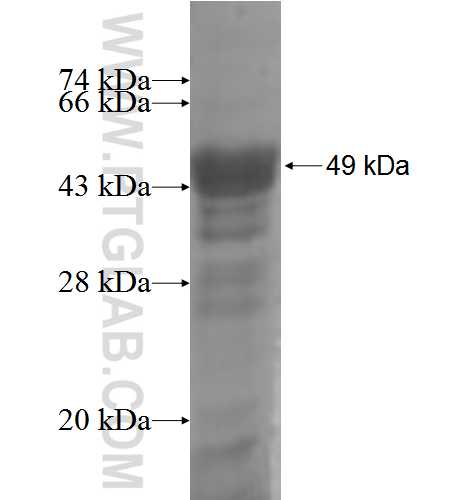 FAM20B fusion protein Ag5912 SDS-PAGE