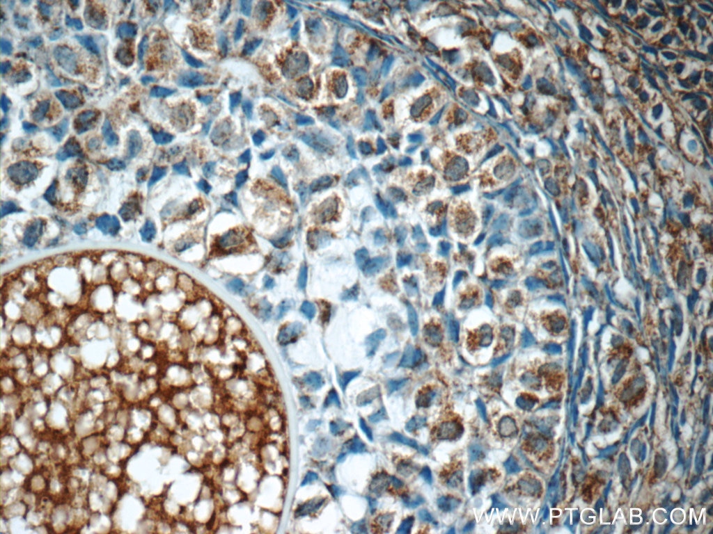 Immunohistochemistry (IHC) staining of human ovary tissue using FAM20C Polyclonal antibody (25395-1-AP)