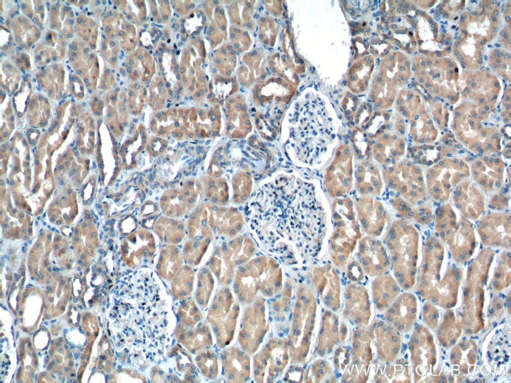 IHC staining of human kidney using 25395-1-AP