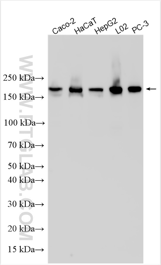 WB analysis using 33208-1-AP (same clone as 33208-1-PBS) Western Blot (WB) analysis of various lysates using FAM21A Polyclonal antibody (33208-1-AP)