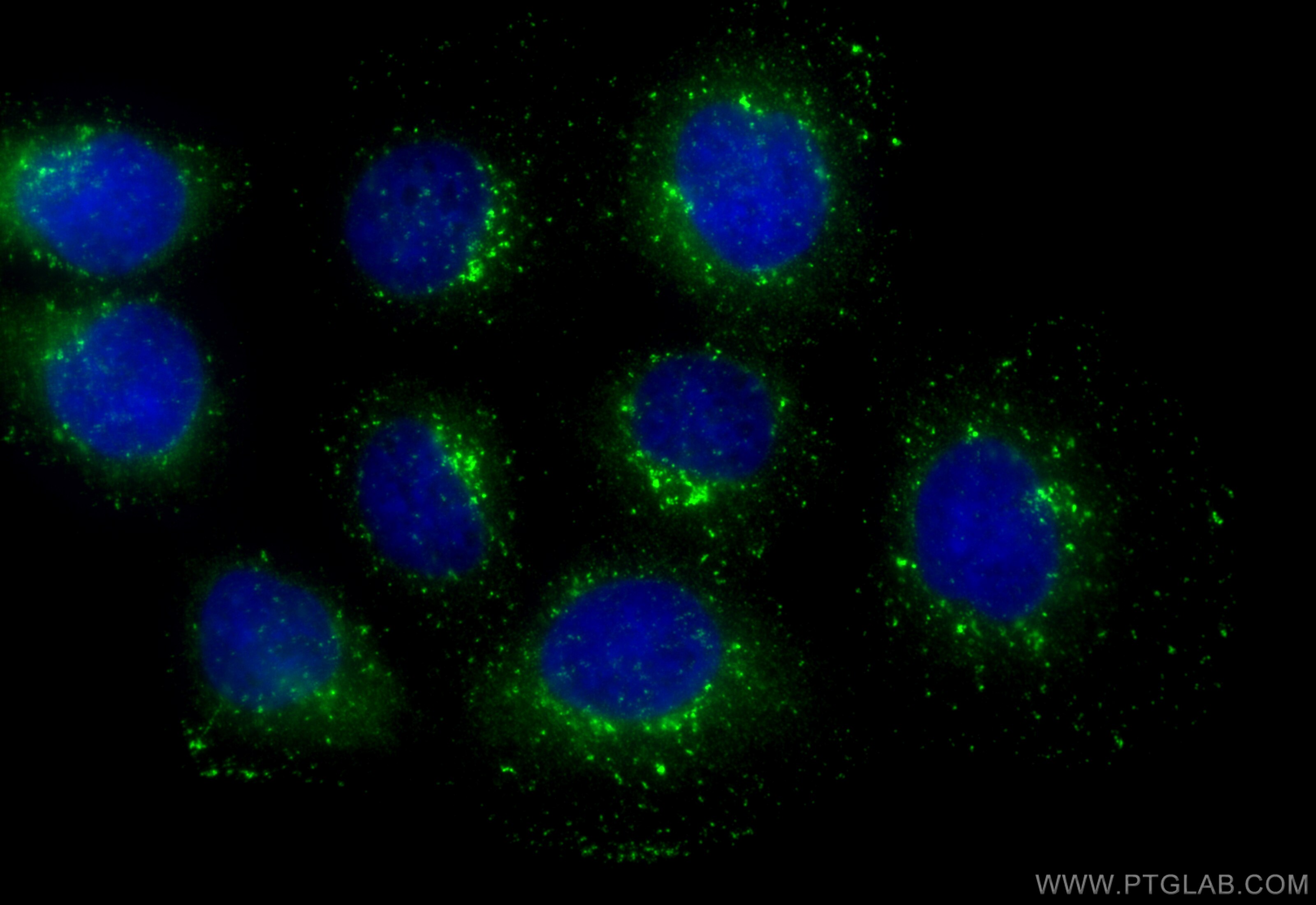 Immunofluorescence (IF) / fluorescent staining of A431 cells using FAM21C Polyclonal antibody (33047-1-AP)