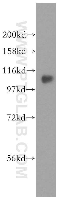 Western Blot (WB) analysis of MCF-7 cells using FAM29A Polyclonal antibody (16933-1-AP)