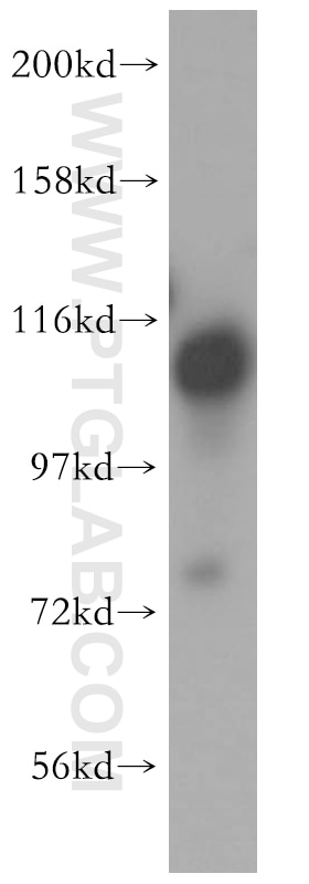 Western Blot (WB) analysis of K-562 cells using FAM29A Polyclonal antibody (16933-1-AP)